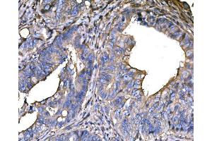 IHC analysis of SNAP23 using anti-SNAP23 antibody (ABIN7603236). (SNAP23 Antikörper  (N-Term))