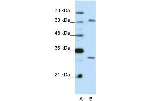 WB Suggested Anti-AUH Antibody Titration:  0. (AUH Antikörper  (C-Term))