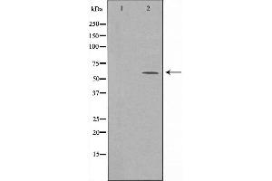 Western blot analysis of extracts from 293 cells, using CDK5RAP3 antibody. (CDK5RAP3 Antikörper)