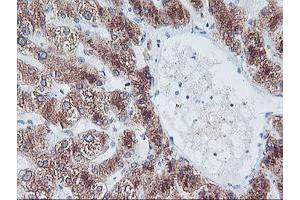 Immunohistochemical staining of paraffin-embedded Human liver tissue using anti-FBXO21 mouse monoclonal antibody. (FBXO21 Antikörper)