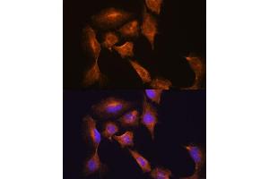 Immunofluorescence analysis of C6 cells using HOOK3 antibody (ABIN7267781) at dilution of 1:100. (HOOK3 Antikörper  (AA 489-718))