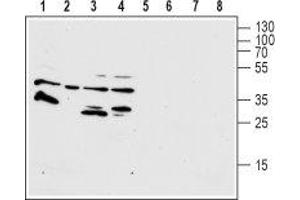 Western blot analysis of human HL-60 promyelocytic leukemia (lanes 1 and 4), human THP-1 acute monocytic leukemia (lanes 2 and 6), human T-84 colorectal carcinoma (lanes 3 and 7) and human U-87 MG glioblastoma (lanes 4 and 8) cell lysates: - 1-4. (FPR1 Antikörper  (2nd Extracellular Loop))