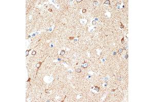 Immunohistochemistry (IHC) image for anti-Tumor Necrosis Factor Receptor Superfamily, Member 10d, Decoy with Truncated Death Domain (TNFRSF10D) antibody (ABIN7271063)