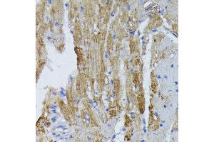 Immunohistochemistry of paraffin-embedded mouse heart using ACADL antibody (ABIN1678519, ABIN3015429, ABIN3015430 and ABIN6216381) at dilution of 1:100 (40x lens). (ACADL Antikörper  (AA 31-210))