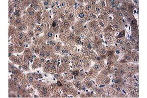 Immunohistochemical staining of paraffin-embedded Human thyroid tissue using anti-L1CAM mouse monoclonal antibody. (L1CAM Antikörper)