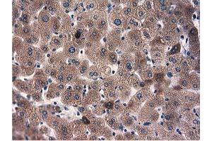 Immunohistochemical staining of paraffin-embedded Human thyroid tissue using anti-L1CAM mouse monoclonal antibody.