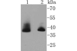 Lane 1: Hela, Lane 2: MCF-7 cell lysate probed with Aurora B (1G9) Monoclonal Antibody  at 1:1000 overnight at 4˚C. (Aurora Kinase B Antikörper)