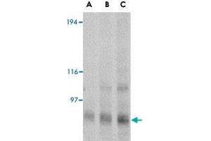 Western blot analysis of GRIK4 in rat brain tissue lysate with GRIK4 polyclonal antibody  at (A) 0. (GRIK4 Antikörper  (N-Term))