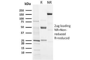 SDS-PAGE Analysis Purified Aurora B Rabbit Recombinant Monoclonal (AURKB/3121R). (Rekombinanter Aurora Kinase B Antikörper  (AA 89-251))