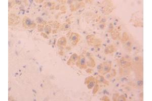 DAB staining on IHC-P; Samples: Human Liver Tissue (SIGLEC9 Antikörper  (AA 23-142))
