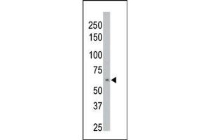 Image no. 1 for anti-Protein Phosphatase, Mg2+/Mn2+ Dependent, 1D (PPM1D) (C-Term) antibody (ABIN360767)