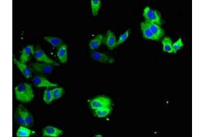 Immunofluorescent analysis of HepG2 cells using ABIN7174052 at dilution of 1:100 and Alexa Fluor 488-congugated AffiniPure Goat Anti-Rabbit IgG(H+L) (TYRO3 Antikörper  (AA 728-873))