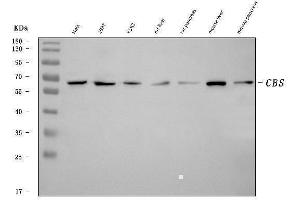 Western blot analysis of CBS using anti-CBS antibody (ABIN7599635).