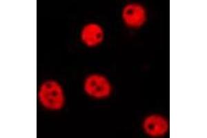 ABIN6275684 staining Hela by IF/ICC. (ZBTB40 Antikörper  (Internal Region))