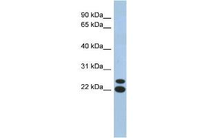 WB Suggested Anti-C19orf54 Antibody Titration: 0. (C19orf54 Antikörper  (N-Term))