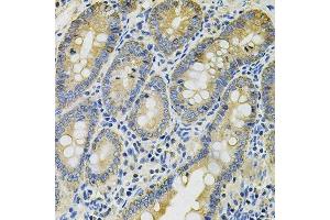 Immunohistochemistry of paraffin-embedded rat intestine using KRT20 Antibody. (KRT20 Antikörper  (AA 245-424))