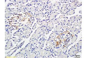 Formalin-fixed and paraffin embedded: rat pancreas tissue labeled with Anti-PP-1B Polyclonal Antibody (ABIN725465), Unconjugated at 1:300 followed by conjugation to the secondary antibody and DAB staining (PPP1CB Antikörper  (AA 155-250))