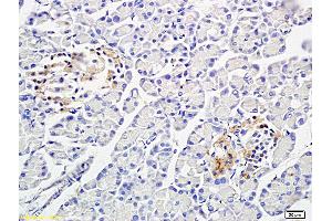 Formalin-fixed and paraffin embedded: rat pancreas tissue labeled with Anti-PP-1B Polyclonal Antibody (ABIN725465), Unconjugated at 1:300 followed by conjugation to the secondary antibody and DAB staining