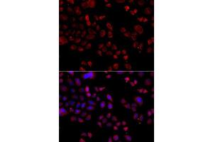 Immunofluorescence analysis of A549 cells using SLC22A11 antibody. (SLC22A11 Antikörper  (AA 40-150))