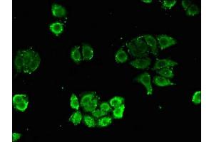 Immunofluorescence (IF) image for anti-Nudix (Nucleoside Diphosphate Linked Moiety X)-Type Motif 21 (NUDT21) (AA 2-227) antibody (ABIN7147921)