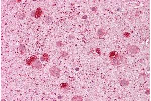 Human brain; Immunohistochemistry with Brain, cortex tissue at an antibody concentration of 5ug/ml using anti-GSH2 antibody ; GSH2 antibody - N-terminal region in Human brain cells using Immunohistochemistry (GSX2 Antikörper  (N-Term))