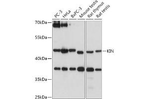 Western blot analysis of extracts of various cell lines, using KIN antibody (ABIN7268118) at 1:1000 dilution. (KIN Antikörper  (AA 180-270))