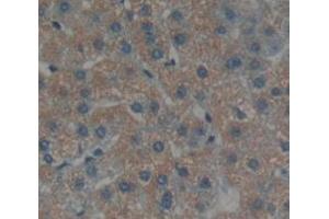 Immunohistochemistry (IHC) image for anti-serpin Peptidase Inhibitor, Clade A (Alpha-1 Antiproteinase, Antitrypsin), Member 6 (SERPINA6) (AA 280-405) antibody (ABIN1858268)