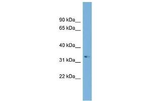 Human Jurkat; WB Suggested Anti-ARL13B Antibody Titration: 0. (ARL13B Antikörper  (C-Term))