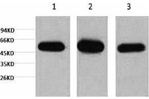 Western blot analysis of 1) Hela, 2) mouse brain tissue, 3) rat brain tissue, diluted at 1:5000.
