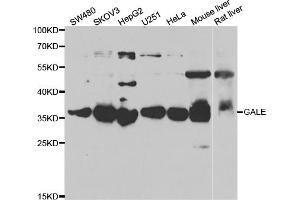 Western blot analysis of extracts of various cell lines, using GALE antibody (ABIN5973962) at 1/1000 dilution. (GALE Antikörper)