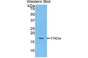 Western Blotting (WB) image for anti-Ly1 Antibody Reactive (LYAR) (AA 271-386) antibody (ABIN1859730) (LYAR Antikörper  (AA 271-386))