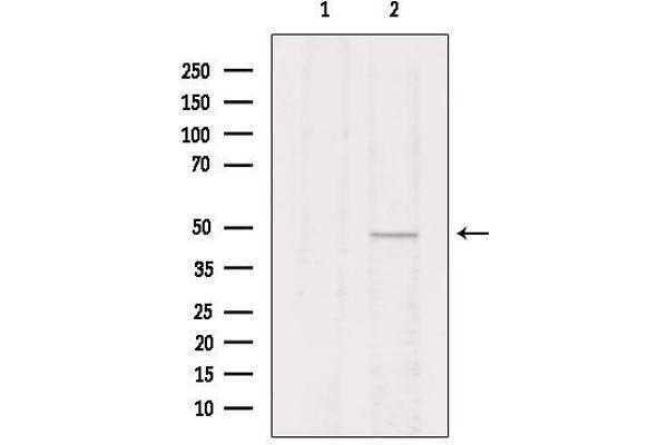 VIPR2 Antikörper  (Internal Region)