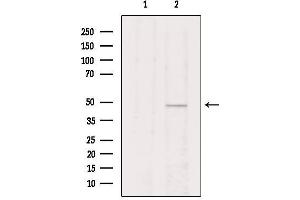 Western blot analysis of extracts from Hela, using VIPR2 Antibody. (VIPR2 Antikörper  (Internal Region))