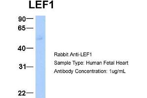 Host:  Rabbit  Target Name:  LEF1  Sample Type:  Human Fetal Heart  Antibody Dilution:  1. (LEF1 Antikörper  (Middle Region))