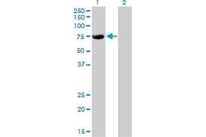 Western Blot analysis of CBFA2T2 expression in transfected 293T cell line by CBFA2T2 monoclonal antibody (M15), clone 2C10.