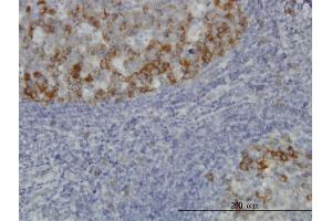 Immunoperoxidase of monoclonal antibody to BUB1B on formalin-fixed paraffin-embedded human tonsil. (BUB1B Antikörper  (AA 1-130))