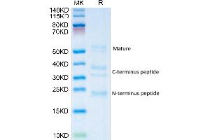 Human RGM-C on Tris-Bis PAGE under reduced condition.