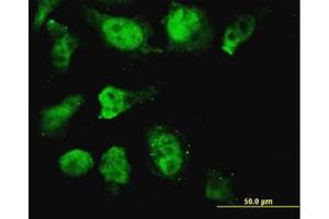 Image no. 3 for anti-Homeobox D11 (HOXD11) (AA 1-77) antibody (ABIN599383) (HOXD11 Antikörper  (AA 1-77))