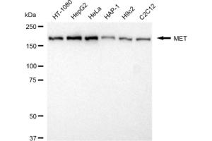 Western blotting analysis using MET antibody (ABIN7799373).