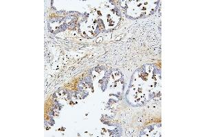 IHC analysis of TEK using anti-TEK antibody (ABIN7600762). (TEK Antikörper  (AA 23-616))