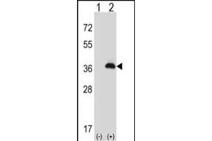 Western blot analysis of PEX16 (arrow) using rabbit polyclonal PEX16 Antibody (Center) (ABIN653096 and ABIN2842688).
