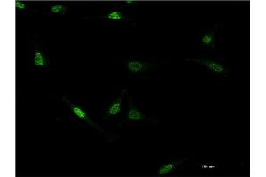 Immunofluorescence of monoclonal antibody to ZNF76 on HeLa cell. (ZNF76 Antikörper  (AA 471-570))