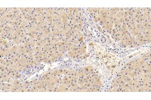 Detection of ADRP in Human Liver Tissue using Polyclonal Antibody to Adipose Differentiation Related Protein (ADRP) (ADRP Antikörper  (AA 5-232))