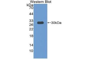 Western blot analysis of the recombinant protein. (Paxillin Antikörper  (AA 347-578))