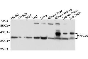 Western blot analysis of extracts of various cells, using NACA antibody. (NACA Antikörper)