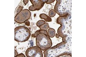 Immunohistochemical staining (Formalin-fixed paraffin-embedded sections) of human placenta with PDLIM2 polyclonal antibody  shows strong membranous and cytoplasmic positivity in trophoblastic cells. (PDLIM2 Antikörper)