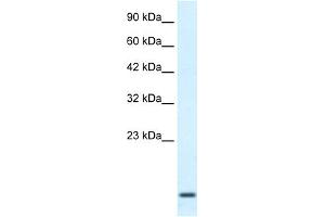 WB Suggested Anti-HOXA1 Antibody Titration:  2. (HOXA1 Antikörper  (Middle Region))