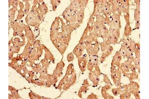 Immunohistochemistry of paraffin-embedded human heart tissue using ABIN7156142 at dilution of 1:100 (IPO13 Antikörper  (AA 501-700))
