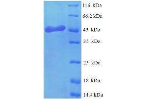 SDS-PAGE (SDS) image for Osteoglycin (OGN) (AA 21-298) protein (His tag) (ABIN5710041)