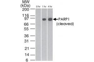 Western blot analysis of cleaved PARP1 in staurosporin-treated Jurkat cells at various time points, using PARP1 monoclonal antibody, clone 194C1439  at 2 ug/mL . (PARP1 Antikörper  (Cleavage Site))